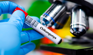 Microscopio y muestra de Chikungunya